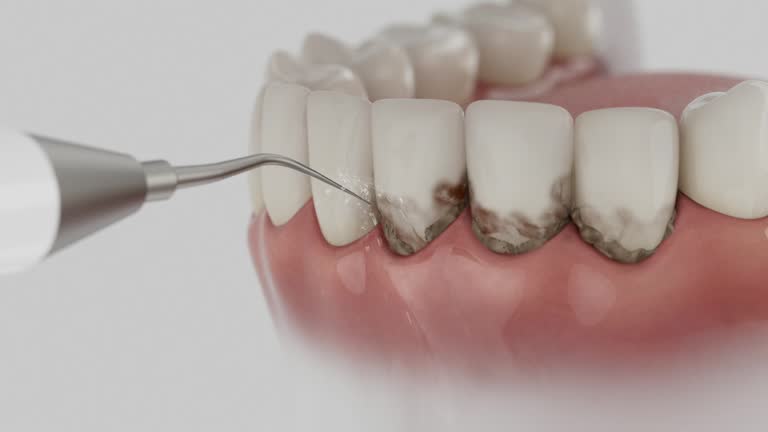 Reliable Emergency Dentist contractor in Riverview, MO by Smile Center Dentistry